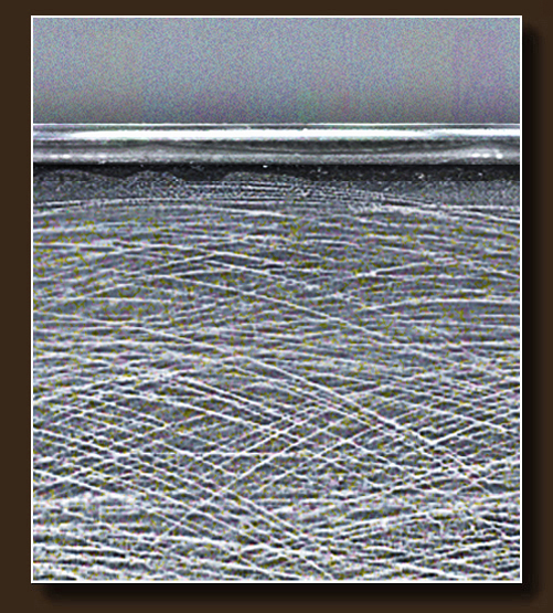 RA2_z2
